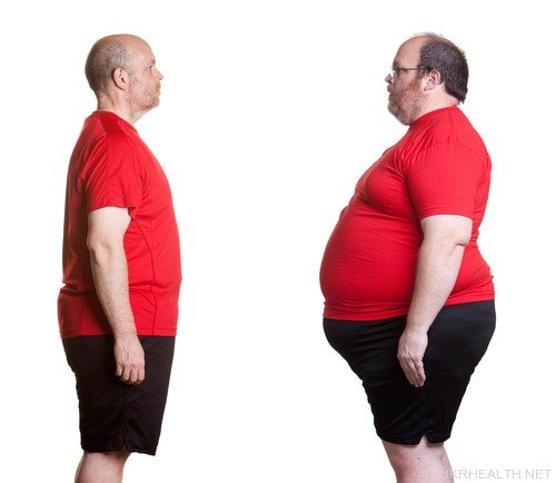 Ожиріння: коли вага стає вже зайвою?