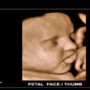 Нова УЗ система показує обличчя майбутньої дитини