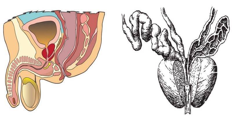 prostatita si imaginea sedentara modula trataprostată