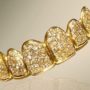 Стоматологи в Дубаї створили «найдорожчу посмішку у світі»