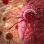 Види раку, які протікають безсимптомно. Три з них є вкрай небезпечними для чоловіків