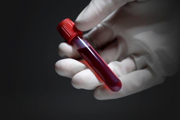 аналіз крові