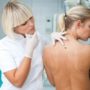 Рак шкіри: як знизити ризик захворювання розповів експерт