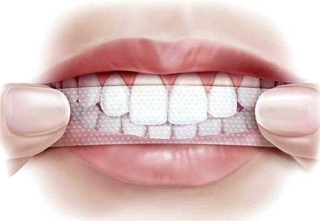 Смужки для відбілювання зубів