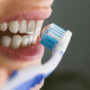 Лікарі розповіли про наслідки неправильного чищення зубів