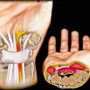 Біль в зап’ясті і оніміння пальців рук: лікуємося народними засобами