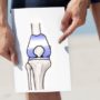 Потужний засіб для зміцнення хрящів і зв’язок: ваші коліна будуть сильними як в 20 років