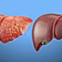 ТОП-6 продуктів для детоксикації печінки