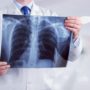 Чи правда, що МРТ і рентген небезпечні для здоров’я