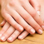 Чому білі смужки на нігтях до біди: нігті як показник здоров’я всього організму