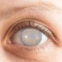 Катаракта: 7 дуже ранніх ознак найпоширенішої хвороби очей