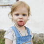 Язик не поміщається в роті: у маленької українки виявили страшну хворобу