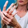 Вчені: гарячі руки – ознака ревматоїдного артриту