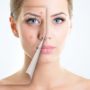 Лікар-дерматолог: прищі на різних ділянках обличчя можуть вказувати на різні хвороби