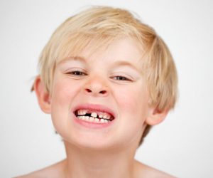 Как сохранить молочные зубы ребенка здоровыми
