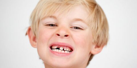 Как сохранить молочные зубы ребенка здоровыми