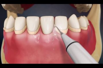 Чищення зубів