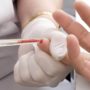 Чому аналіз крові беруть з безіменного пальця?