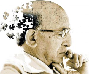 Хвороба Альцгеймера