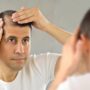 6 способів зупинити випадання волосся у чоловіків