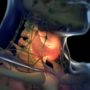 Лікарі перерахували п’ять ранніх ознак проблем з щитовидною залозою
