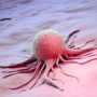 Чому деякі види раку виявляють на пізніх стадіях: онколог