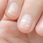 Зміни текстури та кольору нігтів можуть розповісти про проблеми зі здоров’ям