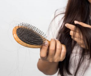 Випадання волосся