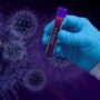 Коли хворий на коронавірус найбільш небезпечний: дослідження