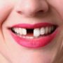 Вчені зі США: кожен відсутній зуб збільшує ризик недоумства на 1,1%