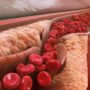 Високий холестерин: симптом на шкірі попередить про проблеми з судинами