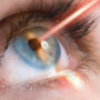 Коли лазерна корекція зору може завдати більше шкоди, ніж користі