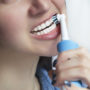 Експертка назвала 5 здорових звичок, які насправді шкідливі для зубів
