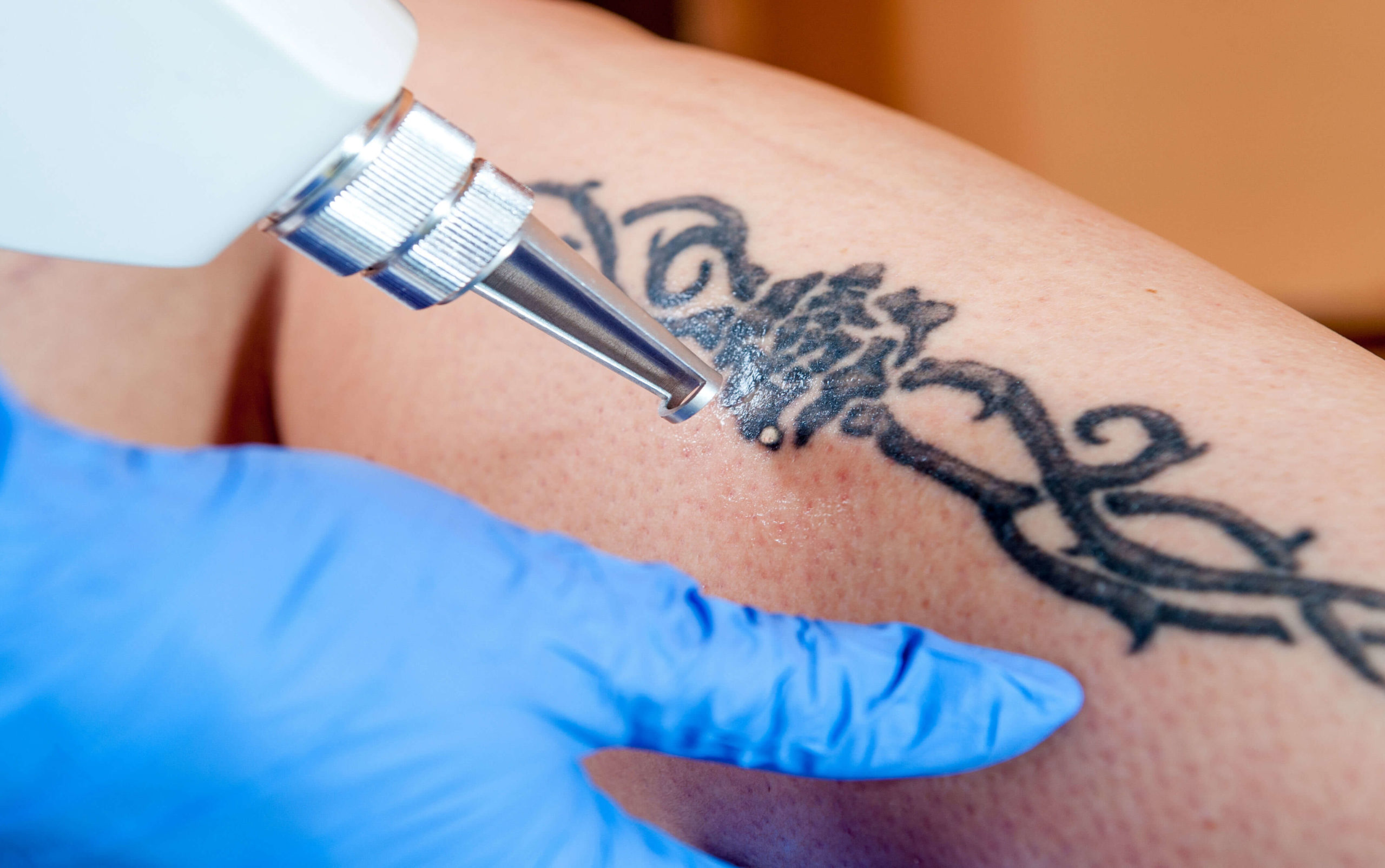 можно ли медикам иметь татуировки на руке